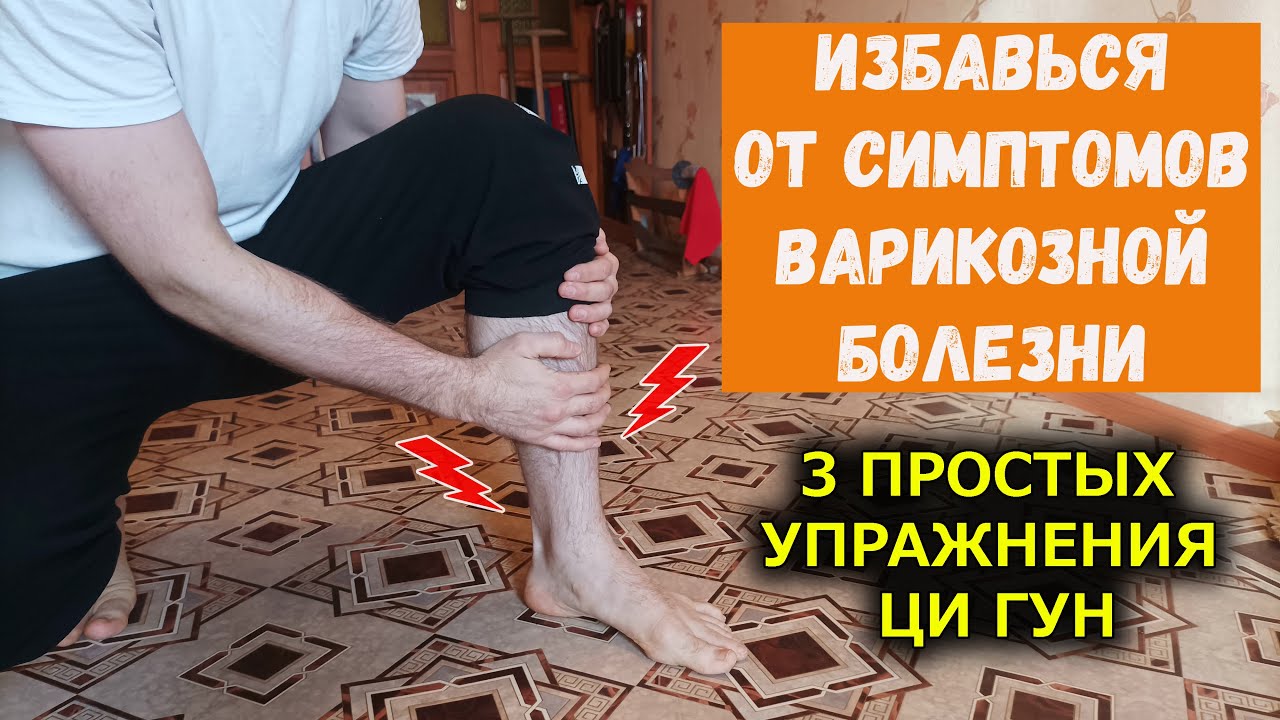 3 упражнения Ци Гун от варикоза - YouTube