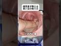 歯医者が教える臭い玉の取り方#Shorts