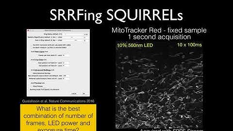 SRRF and SQUIRREL