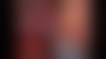 Robotic Right Hemicolectomy with Complete Mesocolic Excision