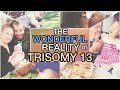 The Wonderful Reality of Having a Trisomy Child || Trisomy 13 / Patau Syndrome  (13トリソミー)