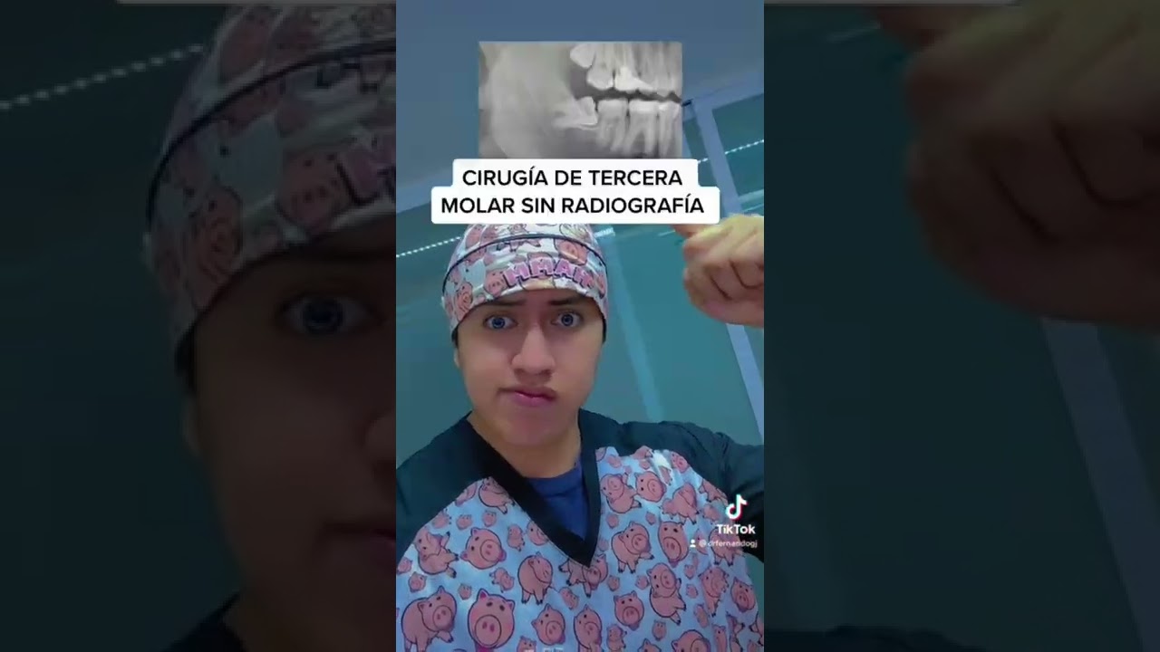 Colo saber si tu dentista hace las cosas mal … 🦷 #dentista #odontologia #dentistry #viral #parati