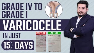 Grade 4 Varicocele Treatment | #Varicocele Natural Treatment |  Dr. Health screenshot 4