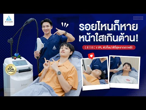 Celec-V-IPL-ตัวท็อป-ดีที่สุดจา