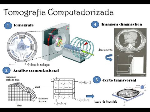 Tomografia Computadorizada - Tópicos gerais