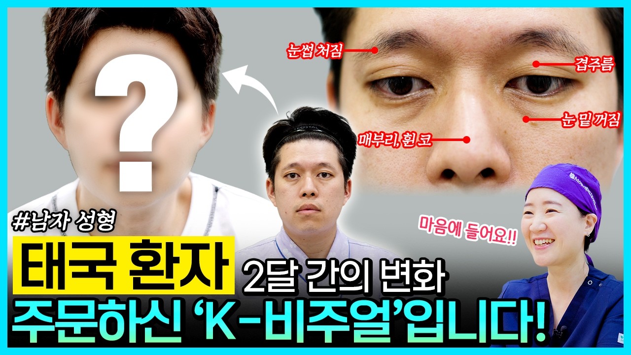 #남자성형 #남자코성형 #눈매교정 #눈밑지방재배치 #실리프팅  #매부리코 #짧은코 #이중턱지방흡입 #성형부기 #성형외과리얼스토리 #성형전후 #회복기간 #제이준성형외과피부과