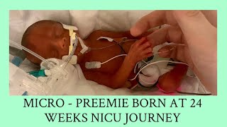 MICRO-PREEMIE BORN AT 24 WEEKS NICU JOURNEY | MARCUS’S STORY