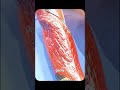 Fish skin heals burns IRL 🐟🔥 | W Medical Hack!