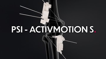 Patient Specific Instrumentation for Tibial Osteotomy - Activmotion S