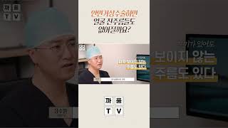 안면거상 수술하면 얼굴 잔주름도 없어질까요? #광주톱스타성형외과
