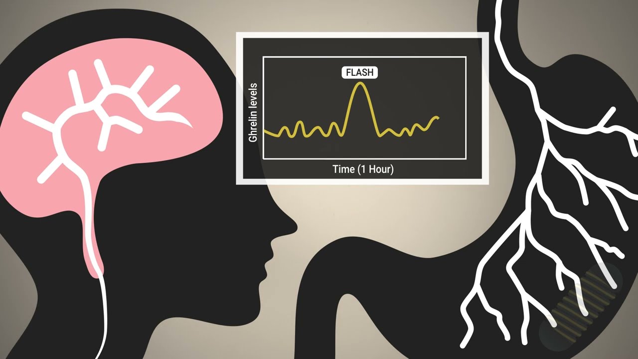 Ingestible “electroceutical” capsule stimulates hunger-regulating