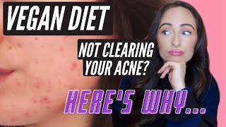 VEGAN DIET MAKING YOUR ACNE WORSE HERES WHY (How To Be A Healthy Vegan) ?