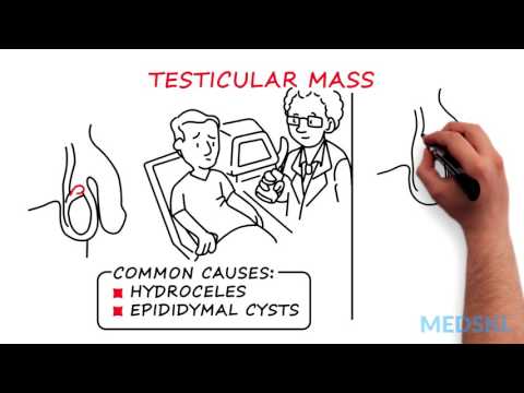 Video: Forskjellen Mellom Testikkelkreft Og Cyste (scrotal Cyste)