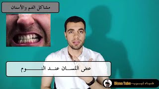 عض اللسان اثناء النوم ضياء تيوب Diyaa Tube