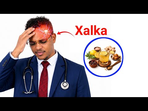 Daawada madax xanuunka joogtada ah ( migraine headache)