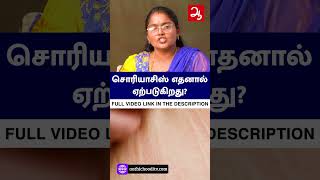 சோரியாசிஸ் உள்ளவர்களை தொட்டால் வந்துவிடுமா   Homeopathy treatment remedy for Psoriasis