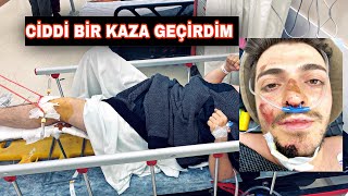 CİDDİ BİR KAZA GEÇİRDİM !