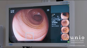 SKOUT Video for Physicians - AI-Assisted Colonoscopies