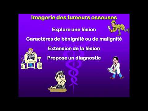 Vidéo: Remodelage De La Matrice Tumorale Et Nouvelles Immunothérapies: La Promesse De Biomarqueurs Immunitaires Dérivés De La Matrice