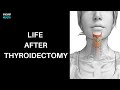 Life after Thyroidectomy