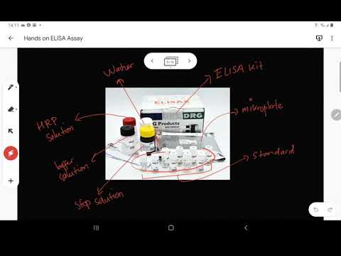 Bagaimana cara pemeriksaan ELISA - Hands on