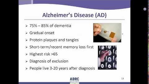 ADRC Video: Dementia Defined & Alzheimers Disease