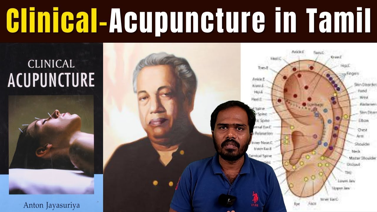 ClinicalAcupuncture in Tamil Anton Jayasuriya Book YouTube