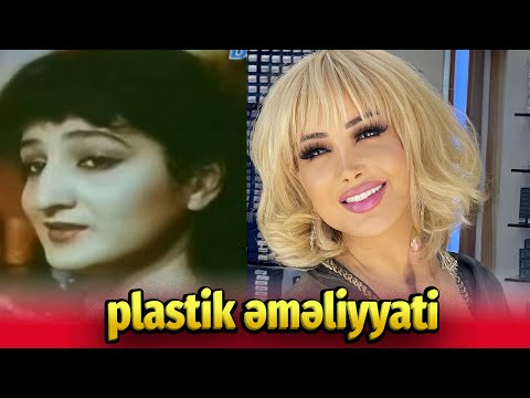 Azərbaycan müğənniləri plastik əməliyyatdan əvvəl - sonra