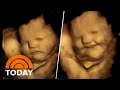 4d ultrasound images show babies possible reaction to flavors