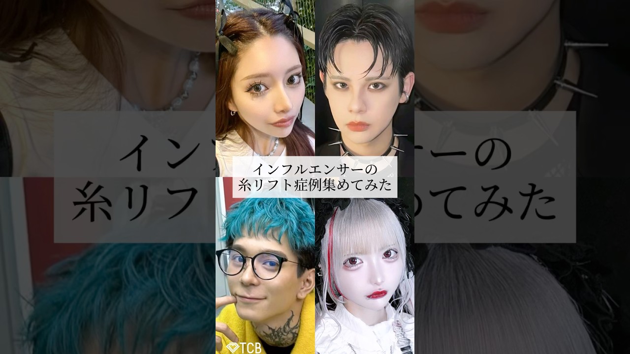 【糸リフト】インフルエンサーの糸リフト症例集めてみた💖