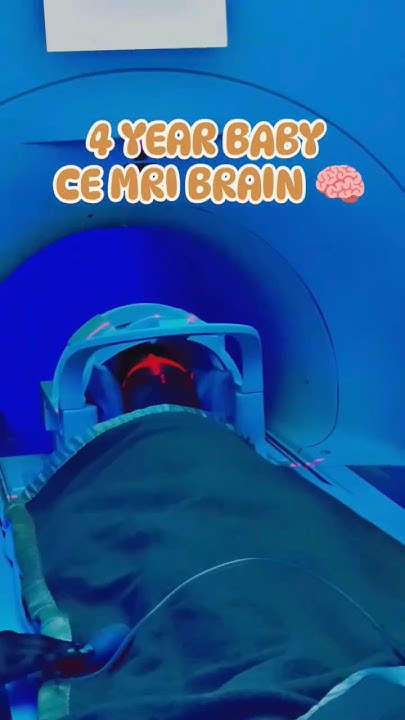 4-year-baby-ce-mri-brain-radiologycareer-mriscan-mriscanner