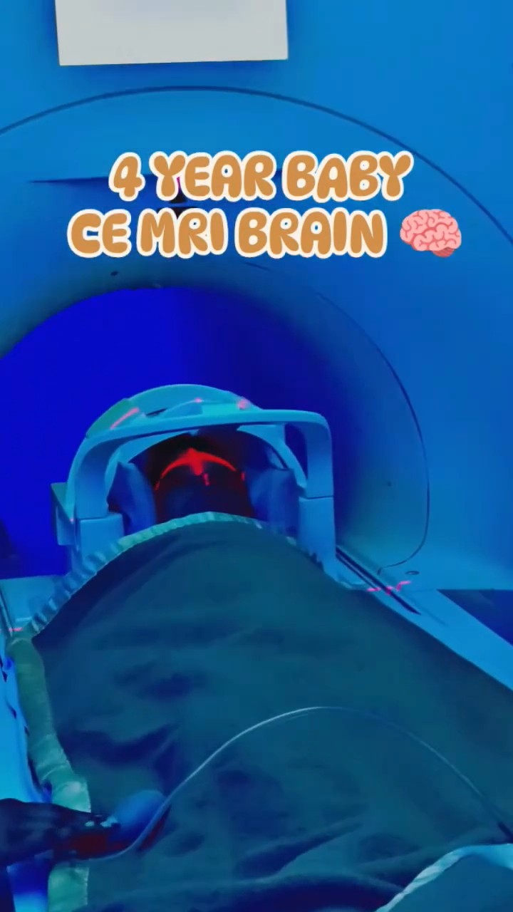 4 Year Baby CE MRI BRAIN radiologycareer mriscan mriscanner 4 Year Baby CE MRI BRAIN radiologycareer mriscan mriscanner