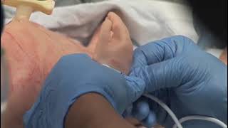 Placement of Pulse Oximeter in the Delivery Room