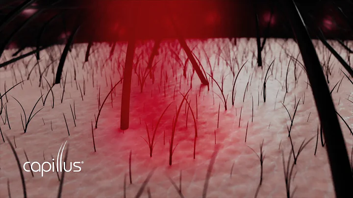 Hair Loss Explained - Animation