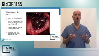 Take The Gastrolearning Express Challenge What Would You Do?