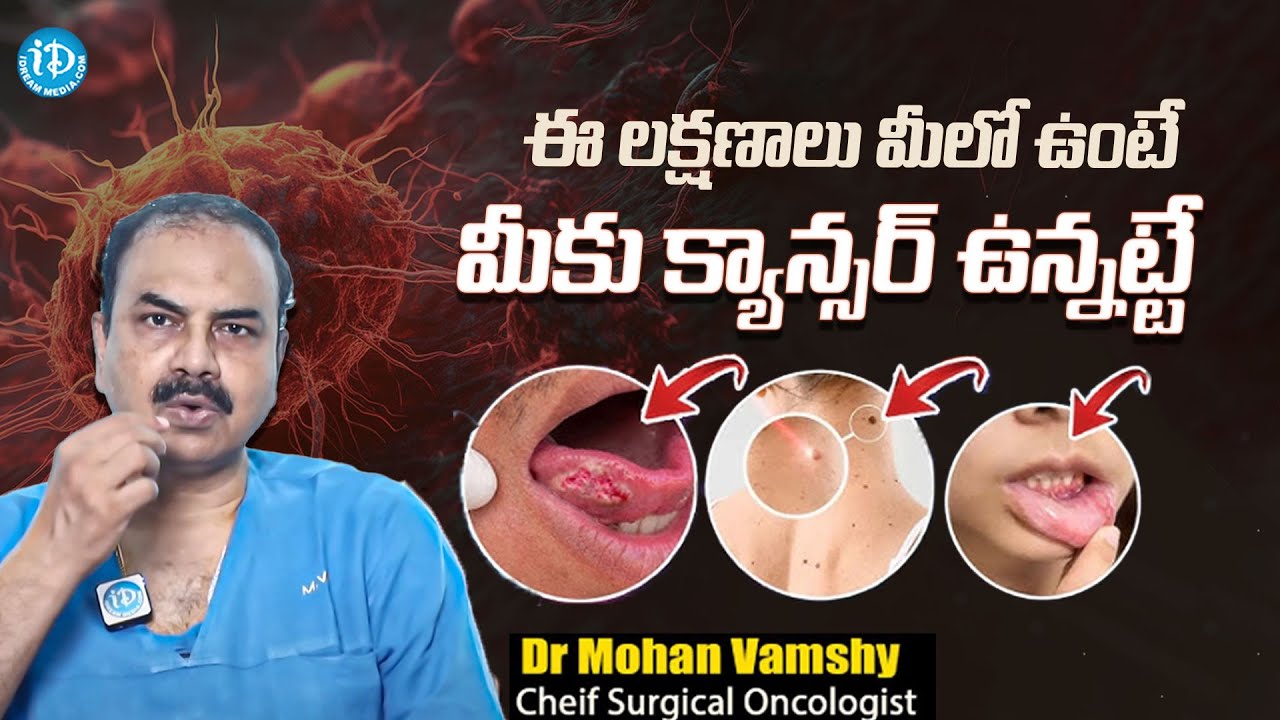 ఒంట్లో ఎక్కడ కాన్సర్ వచ్చినా ముందు కనిపించే లక్షణం ఇదే | Dr.Mohan Vamsi About Cancer | iDream Media