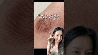 How do you get rid of body pigmentation? #hyperpigmentation #bodyskincare #koreanskincare
