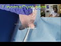 Massive cyst removal . Dr Khaled Sadek Live Chat  11 June 2023.
