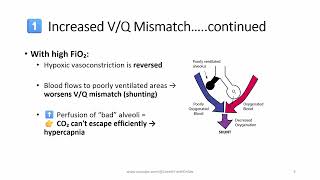 Oxygen-Induced Hypercapnia: What Every Clinician Must Know