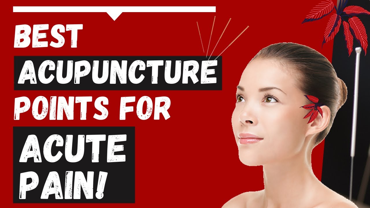 Acupuncture Points for Acute Pain YouTube