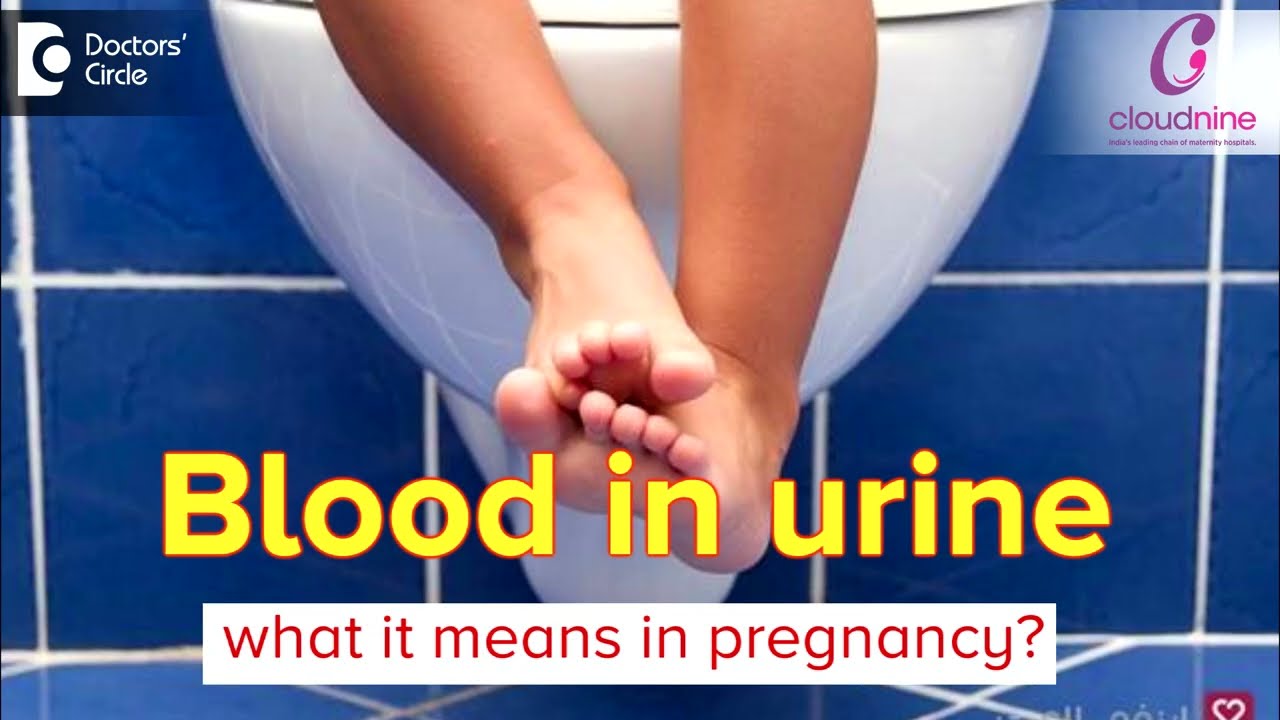 What causes blood in urine during pregnancy? Can it affect