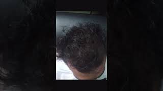 Honest Review After Using Hellovedic Hair Oil | #Hellovedichairoil #mudikozhichil #tharan #akalanara