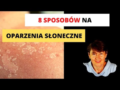 Wideo: Leczenie oparzeń słonecznych – jak zapobiegać oparzeniom słonecznym owoców lub drzew