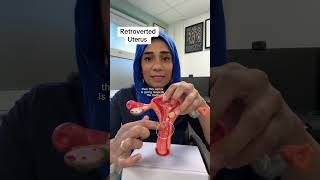 What is an anteverted or a retroverted uterus? #drnighat Uterus Position On Ultrasound Anteverted Vs Retroverted Explained