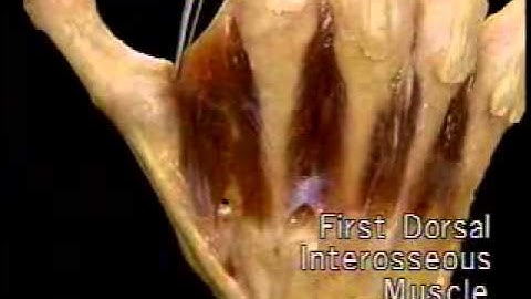 13 Intrinsic muscles 1