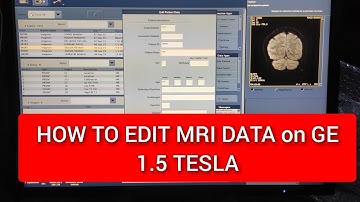 How to Edit MRI Data on GE 1.5 Tesla on YouTube