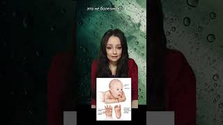 Синдром Дауна. #medical #science #наука #youtube #генетика