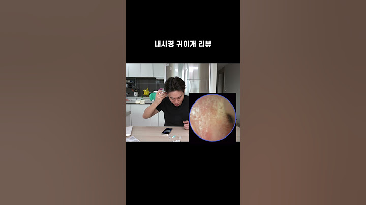 내시경 귀이개 리뷰!!｜귀지｜귀지제거영상｜귀청소