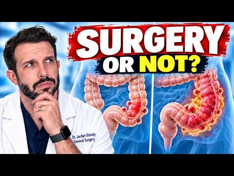 Diverticulitis: When Do You Actually Need Surgery?