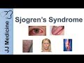 Sjogren’s Syndrome ("Dry Eye Syndrome") | Primary vs. Secondary, Symptoms, Diagnosis and Treatment